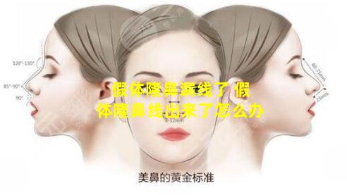 假体隆鼻漏线了 假体隆鼻线出来了怎么办